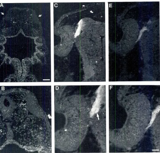 Fig. 1. Immunofluorescencedetectionof total NCAM (180, 140 and 120 kDa isoformsl and 180-NCAM in horizontalsectionsof the olfacto-ry placodeofearlyBufoarenarumembryos.(A)Stage17 embryo.The olfactoryplacodesare seenas a thickenedepithelium(arrows)