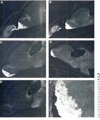 Fig. 4. Total NCAM. 180.NCAMeaten in expression and B-in sagittalsectionsof prometamorphictadpoles.(AI TotalNCAMdistributionintheolfacrory pit.olfactorynerveand olfactorybulbatstage35