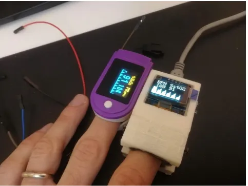 Figure 1: Comparison between a home-made pulsoximeter against a certified one 