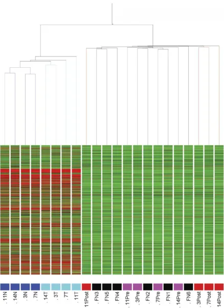 Figure 2. Condition tree distribution of the 4 normal tissue (N; dark blue), 4 tumour tissue (T; light blue), 4 pre-surgery sera (Pre; magenta), 4 post-surgery sera (Post; red), sera specimens, and 6 normal sera (normal / FN; black) data, following dCHIP normalisation.