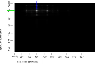 Figure 6.2: Beat Detector overview