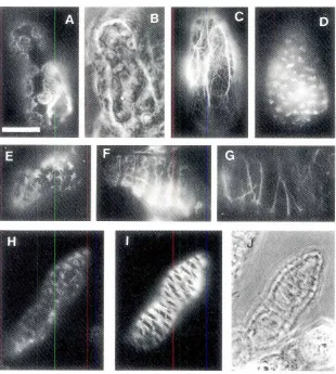 Fig. 5. Changesin the organizationduringof actin filamentsdifferentiationof trachearyelementfrommesophyll cells of Zinnia elegans