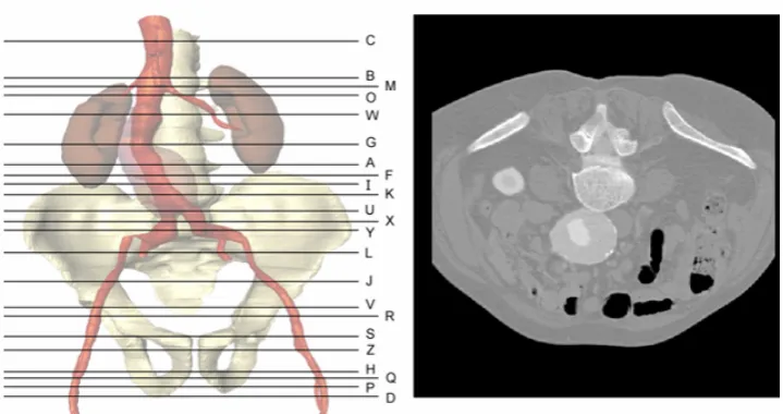 Figure 5. Example of an item of the localization task. Here the line with the letter ‘I’ on the left 