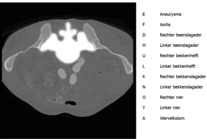 Figure 6. Example of an item of the identification task. Here ‘A’, 