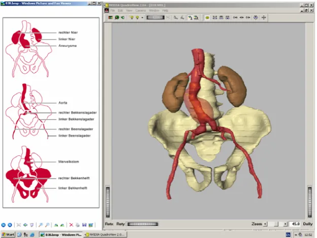 Figure 4. Screenshot of the human abdomen study phase. 