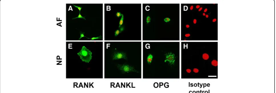 Fig. 2 Detection of basal mRNA expressions of receptor activator of nuclear factor kappa B (RANK between AF and NP cells