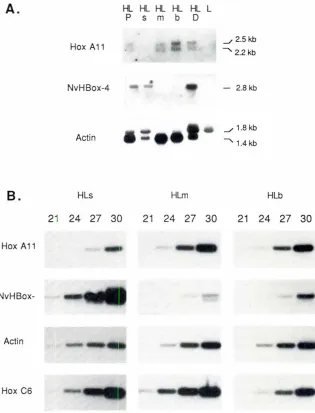 Fig. 4. Tissuedistributionprimedand theof HoxA 11. IAI A North-ern blot of poly(A).RNA(-5 J.IgJ wasseflallyhrbfld-izedwithHoxA 11