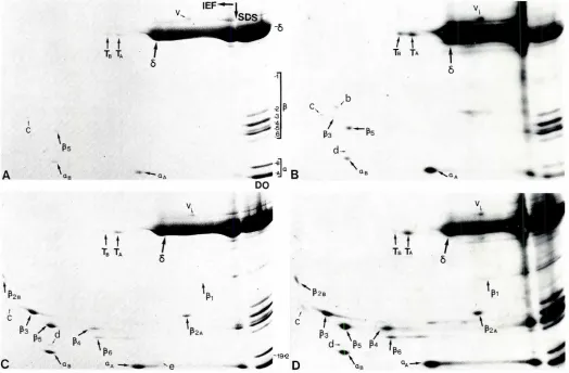 Fig. 5. 2-D gel electrophoresisshowingwater-solubleproteinsexpressedby 7-dayembryonicIA and B} and day-oldpost-hatch(C and DI chicklensesfrom the normalN.J strain.IA,C) Accumulatedprorein(100Jigpergel);(B,D),synthesizedproreinfrom14C_ mixedaminoacids(0