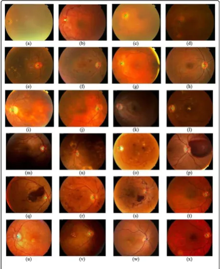 Figure 8. A number of retinal images with 