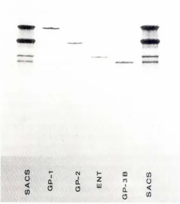 Fig.5. Comparisonof extracellularmatrixproteinsfromM1536-B3cellswithspectrinandfibronectinon sodiumdodecylsulfategel.Extracellularmatrixproteins,(a);erythrocytespectrin,(b),plasmafibronectin, (e); mixture ofextracellufarmatrix proteinsand fibronectin.(d):extracellularmatrixproteins.Ie)
