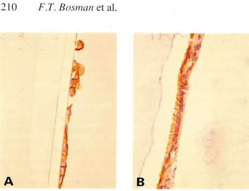 Fig. 7. Redistributionof VlA (B, integrin)ing HT-29cells.expressionon differentiat- (A) a3chain expression circumferential/yonundifferentiatedHT-29 cells
