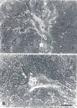 Fig. 7. Effectof basicFGF on lens transdifferentiation.PECs weremaintainedfor30 days with EdFP medium containing basic FGf at aconcentrationof 1, 5, 10 or 30 ng/mf