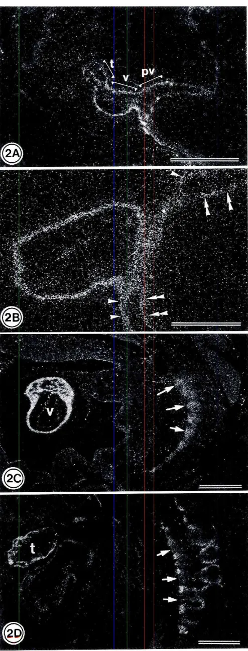 Fig. 2. TnC transcriptsin the earlystagesof ventricularandskeletalmuscles.Ar srage10. CISTnC mRNAwas detecredin truncusarteriosus(tJ ventricle(v), and the proximalregionof vitellinevein(pv) (A!.Highermagnificationof ventricleand vitellinevein at early stag