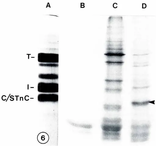 Fig. 6. Autoradiogramarrowhead indicates immunoreactivek correspondingcell-free(A).incubatedbreasr muscleof the translationproductssynthesizedin asystem.A crude extractof cardiac Tn componentsseparatedwith an apparatusof disc type electrophoresis(12% polya