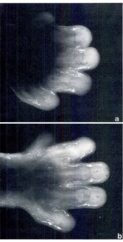 Fig. 6. Whole-mountin situ hybridizationofRARbandRARgin E13mouselimbs.Fetalmouse forelimbs were removed on gestational day 13and placedin organ cultureas previouslydescribed.After1 day of organculture