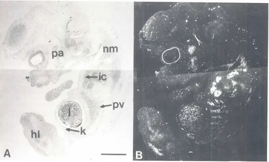 Fig. 2. Light-field(AI andwith antisensenonspecificdark-field(8) photomicrographsof a parasagittalsectionof a'2 dayp.c