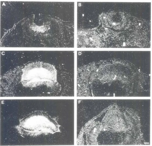 Fig. 6. Localizationof 61-crystallinthroughANA IA. C. EI and bl-crystallinRNA lB. D, FI in the developingeye by in situ hybridizationin transversesectionthe head regionof normalembryosat stageISlA