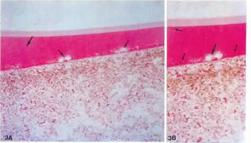 Fig. 3. Resin-embeddedsectionspositive.stainedwithPAS.(AI Egg at the onsetof the plug liquefyingreaction.Theextracellularmarerialindicatedby thea((owis the dimplecontent(DC) whichoccupiesmostofcheconcavIty,i.e.