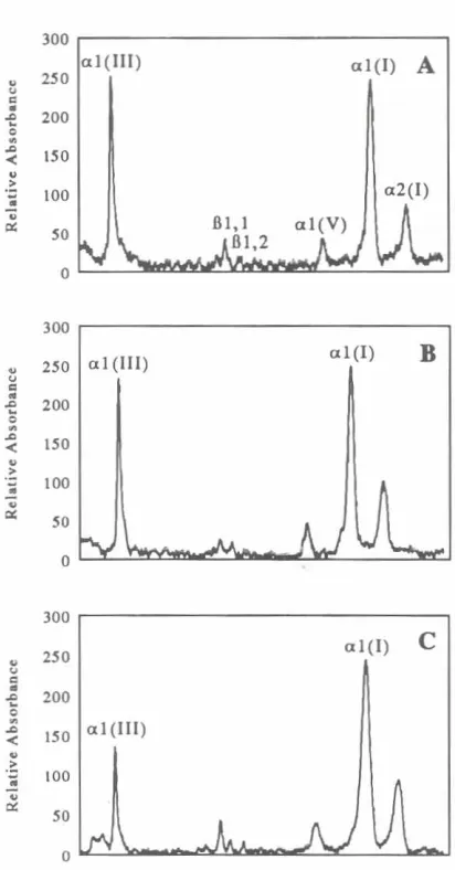 fig.4. Scanningdensitometryof ARGs.Representativescansofprofiles for 24 IAI. 48 161.and 72 IC) h emeet.ere shown.Thereis acleardifferenceIn the relativesizesof rhe a 7(I/I)anda1(1) peaksin A, B