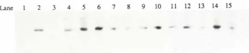 Fig. 5. Distribution of the laeZ transgenein different organs of a new-born chimericmouse containing transfectedES cells (1 F5) detectedby Southernhybridizationof genomicDNA with laeZ probe.Lanes1and 3 contain 70pg control DNA from non-transfected E14cells