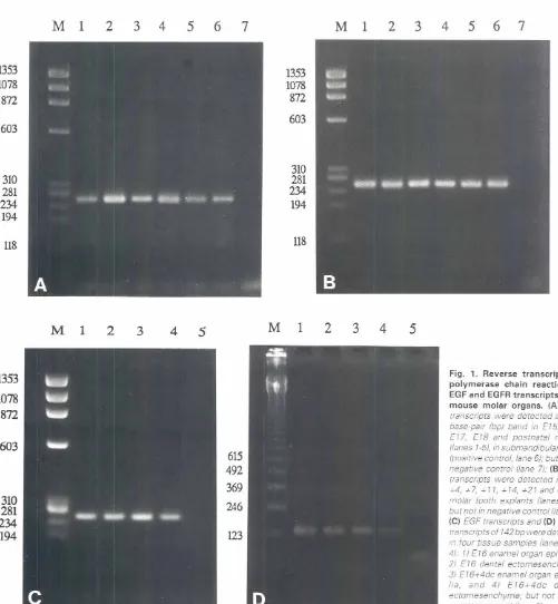 Fig. 1. Reversepolymerasechain