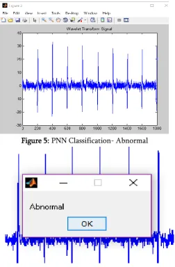 Figure 5: PNN Classification- Abnormal 