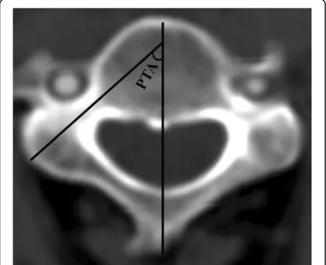 Fig. 2 Measurement of pedicle outer width (POW) on transversereconstruction images of computed tomography