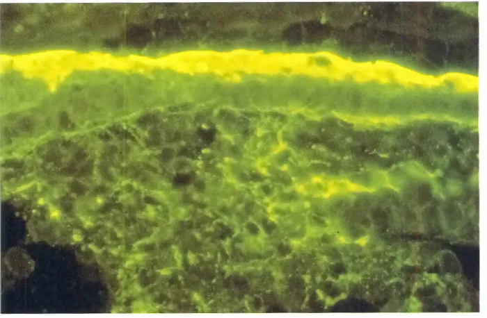 Fig 9. Immunofluorescentmicroscopicdemonstrationonic basement membrane.of lamininin the embry-x 160