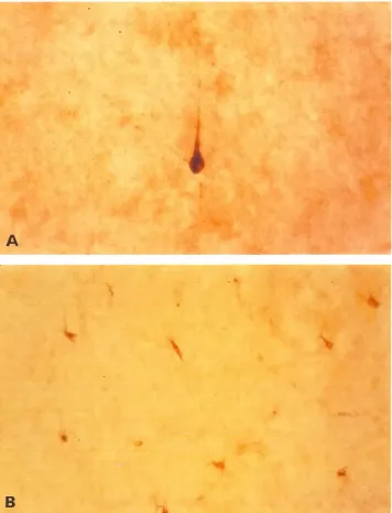 Fig. 4. (AI Somatostatin-immunoreactiveneuron in the subplate zone of rhe frontalcortex of a 23-week-oldhumanfetus