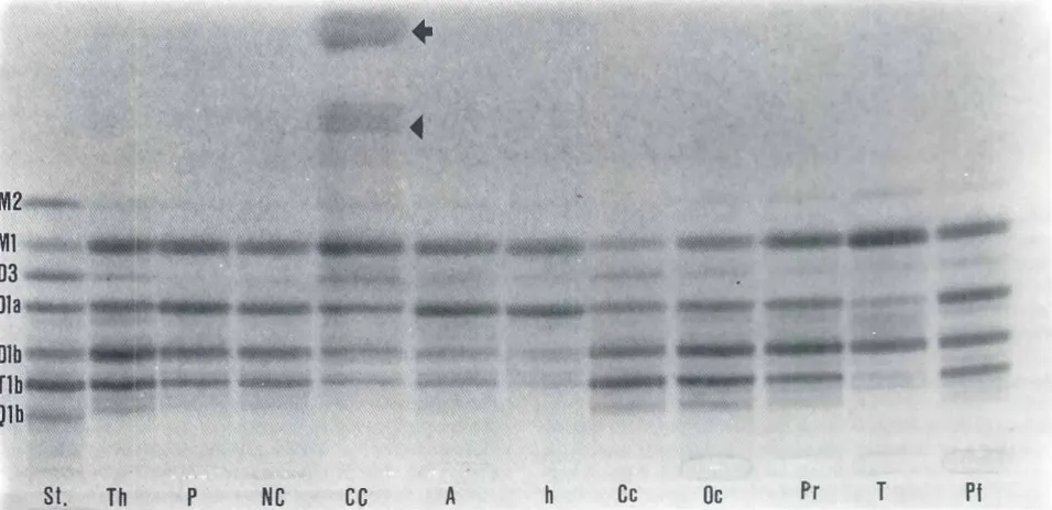 Fig. 3. Immunohistochemicaldistributionof the GD1b gangliosidein the cerebellarcortex of a 1.5 year old child (bl