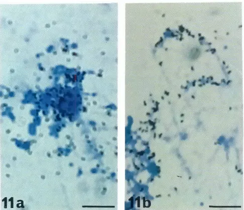 Fig. 11.. .-transcripts In situ hybridizationof microclonedDNA sequences10 RNAon PleurodeJes lampbrushchromosomesGlobular loops(al; granular loops (bl