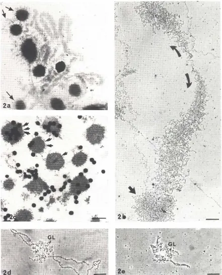 Fig. 2. Visualizationof transcriptionin globularloops(a)RegiOrJof one chromosomeIsola red In a 05MKCI at pH 9 and e),hlbltmgone globularloop(electron microscopy);globular componentsare more or less disorganizedand are due to a dense aggregationof RNP flbnl