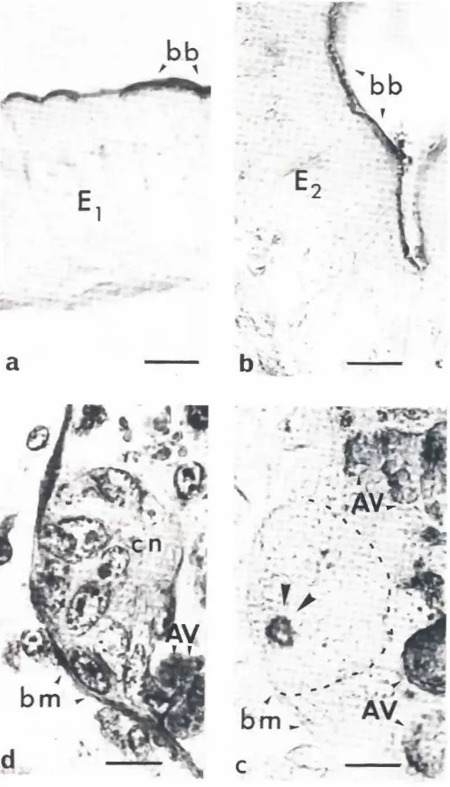 Fig. 3. Immunolocalizationof villin in the metamorphosingJuvenileamphib-ian intestine.In the tadpole(a) as well asIn ehenewly-meramorphosed (bl