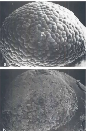 Fig.5. ThechromlSscanningelectronmicroscopicpicturesofnormalgoldfish(Carass;usauratus)blastulaandNCHblastulaobtainedfrom the combinationof Tilapia (Oreo-nilotlca~ nucleusand goldfishcytoplasm,(al Nor-mal goldfishblastula(x200)