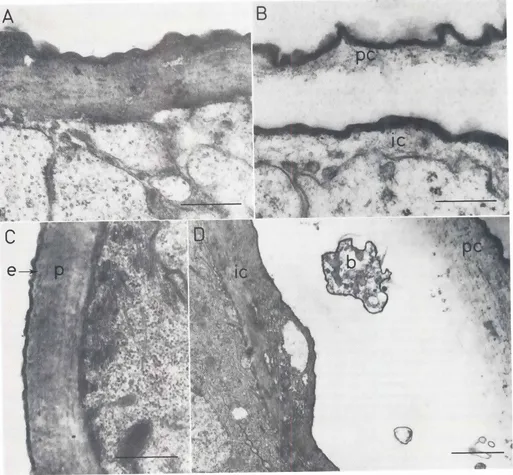 Fig. 4. Imaginal cuticle secretion in discs cultured for 7 days before fixation. (AI Good and (81 poor examplesof adult cuticlesecretionIn controlswhich were not medium changed (culture 3_1J In the latter the procutlcle of both the Imaginal and overlYing a