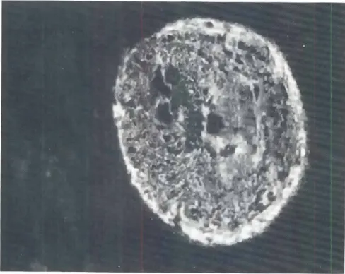 Fig. 1. (a) Cultured(b) Cytok.eratinhumanfibroblastsimmunostainedfor vimentinby using a monoclonalantibody.Notethe densefibrillar reactivityin the cytoplasm.fibrils in rat k.angarooAidneyepithelialcells