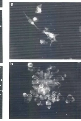 Fig. 9.Y79lamentment-immunoreactivitycultured. retinoblastomacells start to expressphosphorylatedneurofi-proteinsafter exposureto dbcAMP(a) whereasalso the suspension-undifferentiatedWeri Rb 1 retinoblastomacellsexpressneurofila-(b)