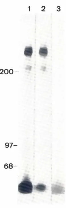 Fig. 1. Model01tenascinaccordingnab 01 each arm: b). the thicA distal segmentReprinted by permissionthe thin inner segment:Macmillanbased on rotary shadowing electron microscopyto EricA-so" andInglesias(1984).Abbreviationsa)