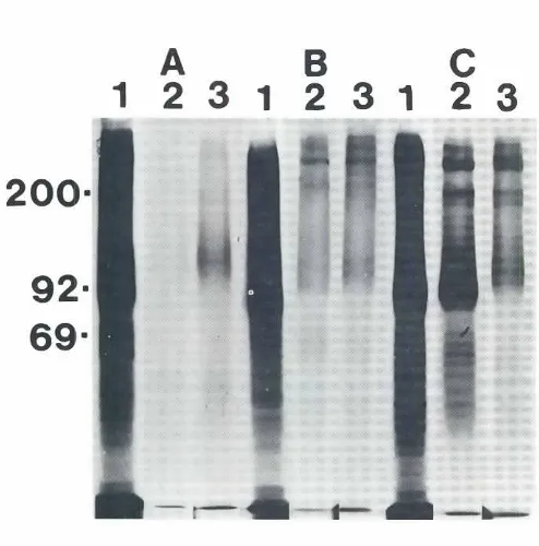 Fig. 7. ~S-methionine-IabeledAMp.nin (lane4). DBA (laneproteinsfrom culturemedium0/ RA;{/bc-treatedF9 cells