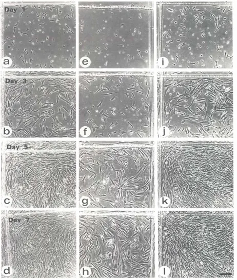 Fig. 2. Comparisonof growthand type I coflagen.rateandcellpatterningof dermalcellsculturedon culturedish plastic(a-d), type f collagen(e-h), orderma tan sulfate(i-I)