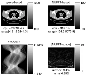 Fig. 7. PWLS-PCG reconstruction (60 iterations) for real X-ray CT fan-beam sinogram data with projectors from Case 2.