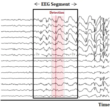Figure 3.3: Selection of an EEG segment with a total duration of four seconds, used forvisualisation