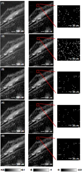 Figure 3.5. In the first column the image reconstruction algorithms were evaluated on images from a stage 54 Xenopus tadpole