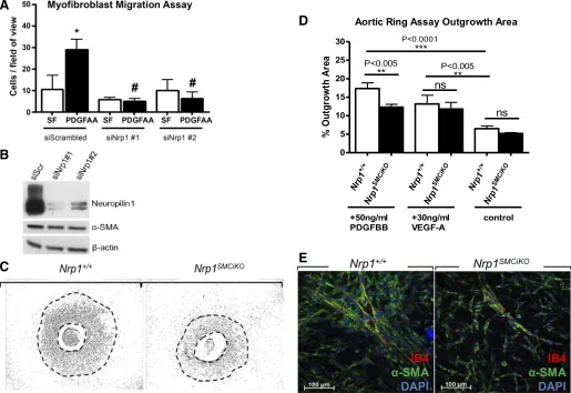 Fig. 4. Nrp1 is required for PDGF-induced migration of myoﬁbroblasts and SMCs. A: pulmonary myoﬁbroblast Transwell migration assays in response toPDGF-AA compared with serum-free (SF; siScrambled, n � 3; siNrp1 #1, n � 3; siNrp1 #2, n � 3)