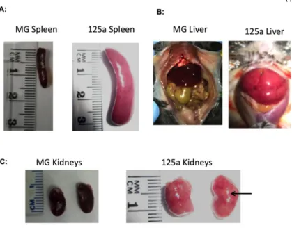 Figure S2: MiR-125a overexpression causes an aggressive leukemia six months post-
