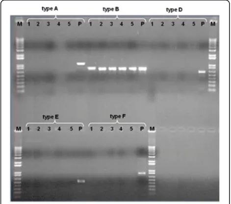 Fig. 1 Capsular typing of the strains. Explanation: Figure showingpositive controls working on all channels and consistent positiveresults for type B for the isolates: Pasteurella/Saigas/2010/ZKO/KZ (1),Pasteurella/Saigas/2011/ZKO/KZ (2), Pasteurella/Saigas/2012/Kostanay/KZ (3), Pasteurella/Saigas/2015/Kostanay/KZ (4) and Pasteurella/Saigas/2015/Akmola/KZ (5), М - 1 kb Marker, Invitrogen, P – typepositive control