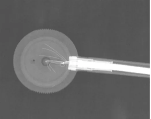 Figure 9.  Radiographs of an Exradin A10 type ionisation chamber 