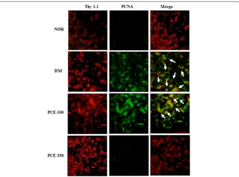 Figure 5 Effect of PCE on mesangial cell proliferation in the renal glomeruli. Immunofluorescence staining was performed with anti-thy 1.1,which is a specific marker for mesangial cells, and anti-PCNA antibody and visualized with Texas-red and fluorescein 