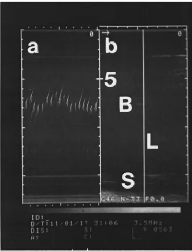 FIG. 8. Greyscale histogram showing heterodyned received signal �fromV302� for each discrete setting of the pump frequency �100-Hz increments�.Light shades indicate strong signal