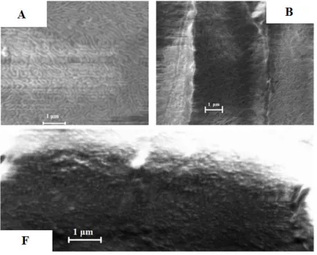 Figure 2. Scanning Electron Microscopy of Brush Block Copolymers of Different Volume Fractions